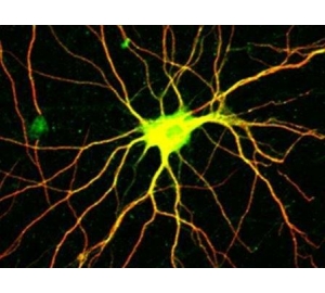 Раскрыта схема работы белка, регулирующего рост нервных клеток